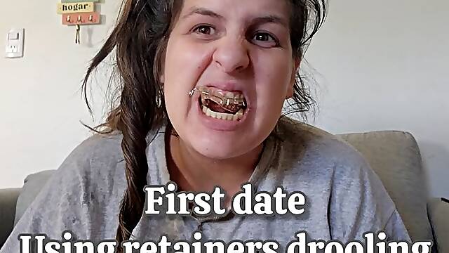 First Date Disaster with Retainers - Lisp Talking, Drooling Saliva Everywhere & They Keep Falling Out POV